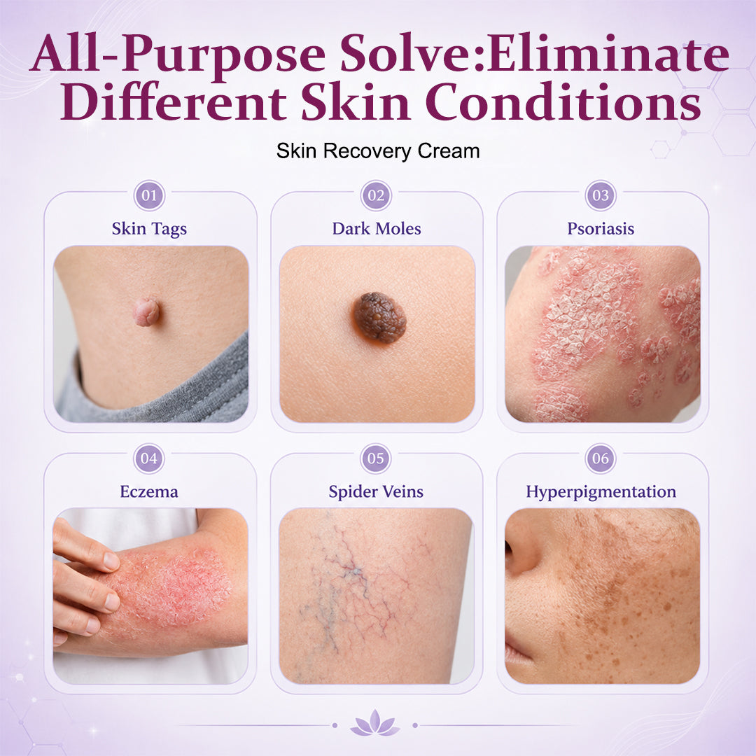 Skin Recovery Cream