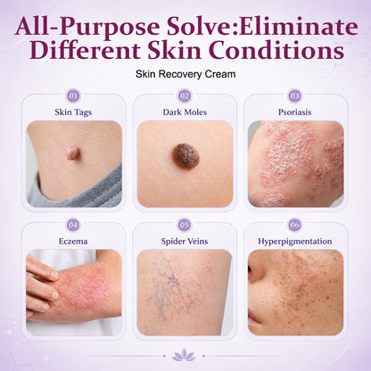 Skin Recovery Cream